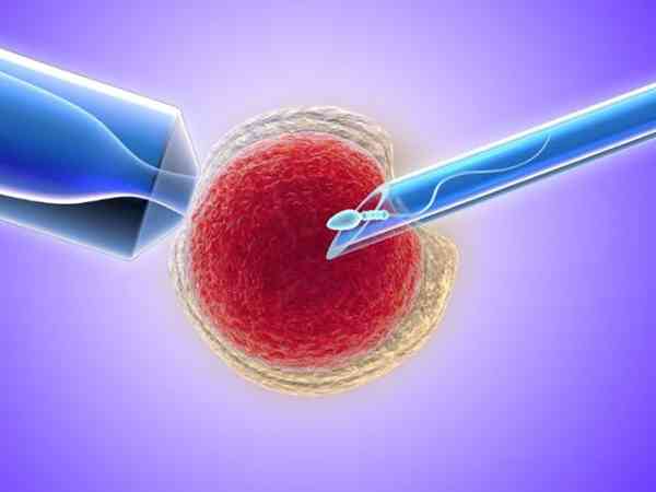 染色体易位患者是养囊难还是筛查难？