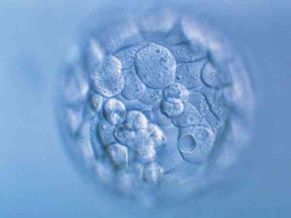 试管取卵5个就配成5个胚胎有可能吗？