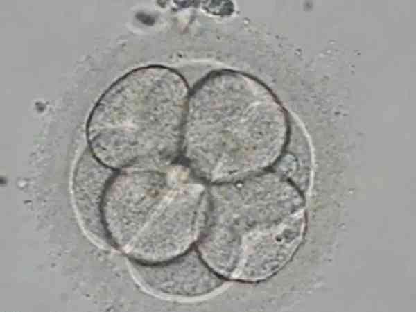 移植3天卵裂期的胚胎好还是5天囊胚好？哪个成功率更高？