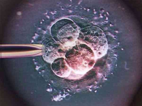 囊胚pgs检测通过率跟遗传因素关系大吗？