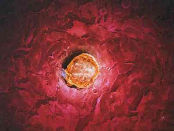 内膜15mm不刮宫移植囊胚成功率高吗？