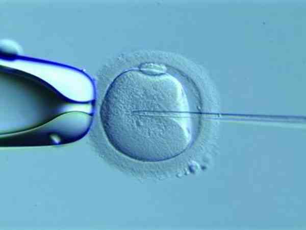 二代试管用单精子注射受精的成功率比较高吗？