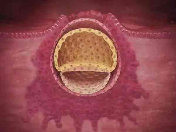 第三天冻胚胎移植后在子宫着床的全过程图是怎样的？