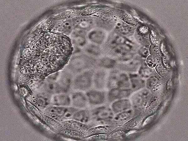 嵌合体百分之40的胚胎移植着床了还会有风险吗？
