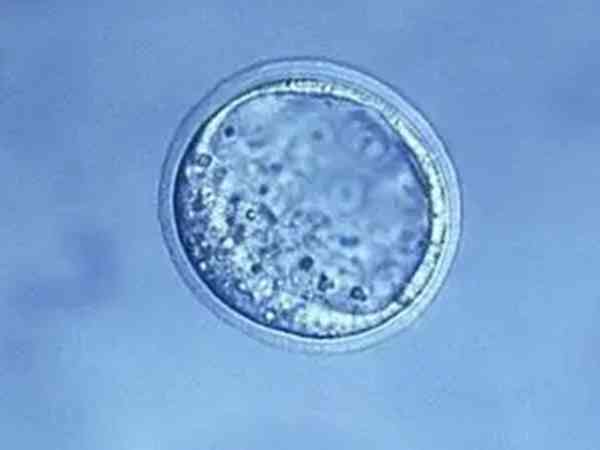 4AC的胚胎和4BB的区别有什么？哪个移植成功率高？