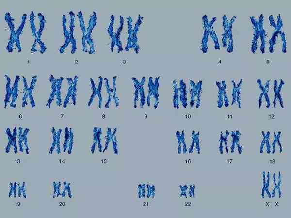 染色体46xy21pss不做三代试管会影响下一代智力吗？