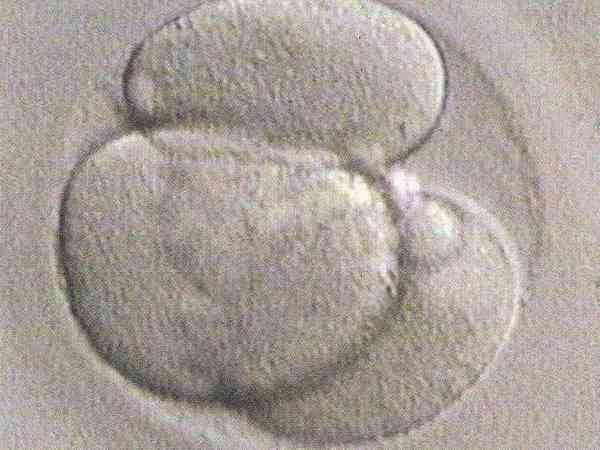 试管移植鲜胚14天生化后需要做清宫处理吗？