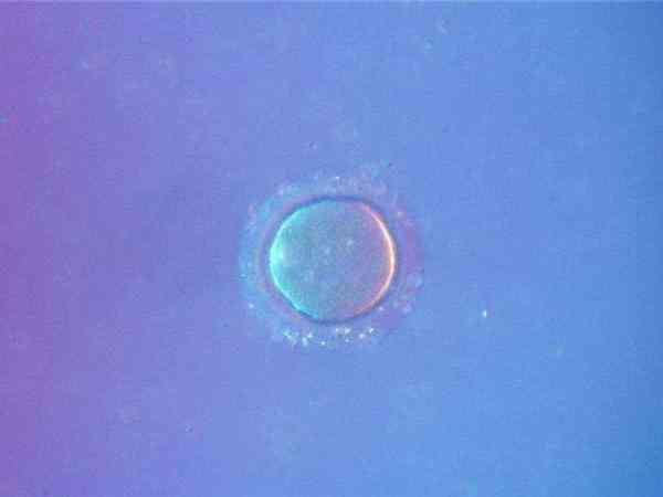 做试管第二胎可以直接用第一次冻的卵受精移植吗？