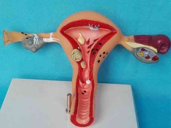 输卵管和子宫位置在人体结构示意图片上是怎么样的？