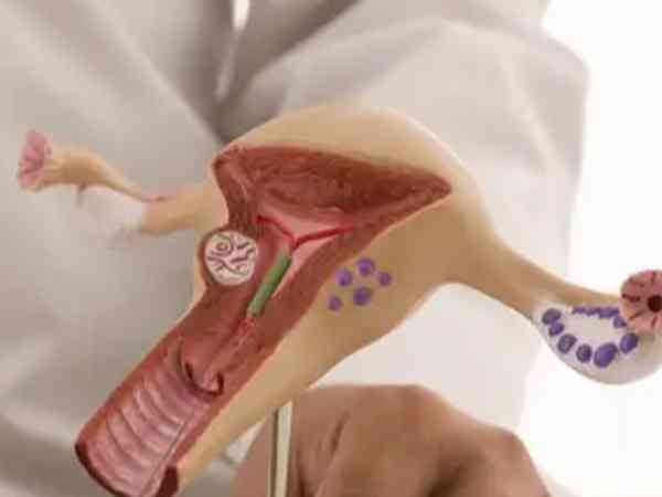 为什么医生不建议输卵管堵塞的女性做人工授精？