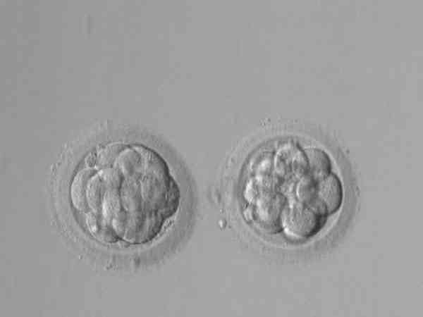 试管移植放两个卵裂胚怀双胞胎的概率有多大？