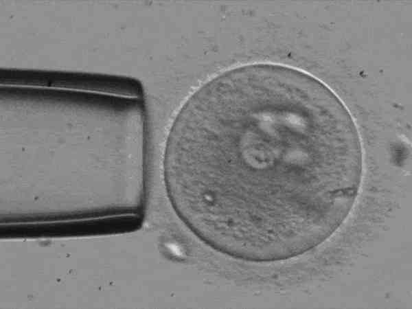 卵子激活术加二代试管可以提高胚胎质量吗？