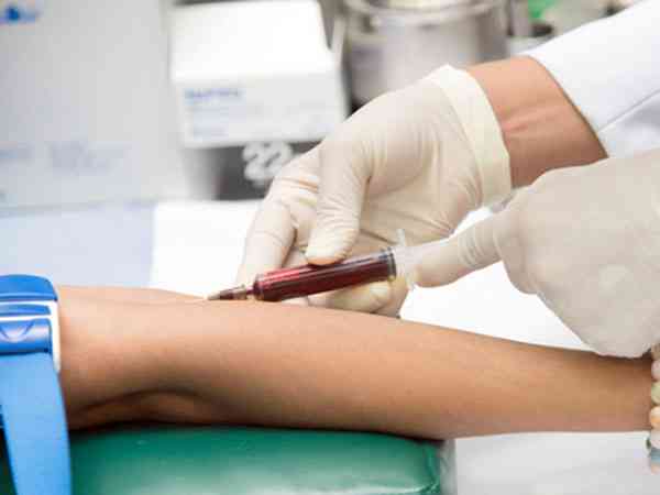准备做试管第一次什么时候去医院抽血做检查比较好？