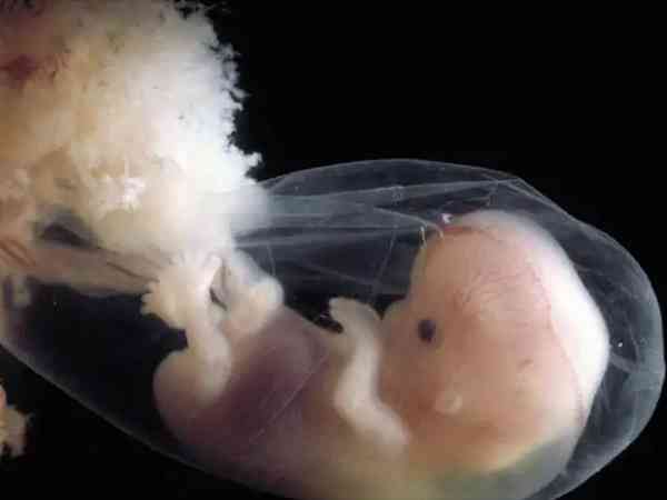 卵黄囊胚芽大小与孕周的关系对照表是怎么样的？