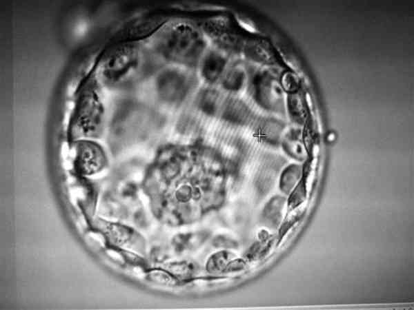 三天鲜胚胎522级别能进行试管移植吗？