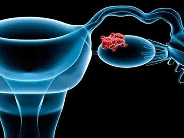 amh检查报告单上的结果怎么看卵巢早衰？  