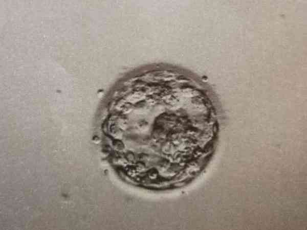 胚胎碎片多就是男女双方精卵互斥的原因导致的？