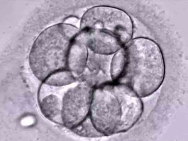 D3的二个832冷冻胚胎质量算差吗？