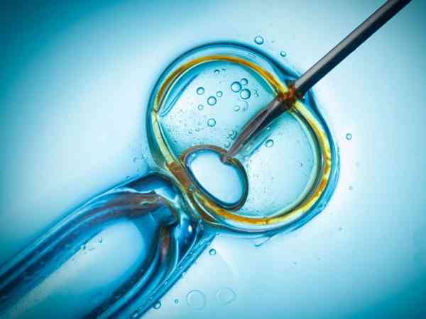 显微取精与取精机取精相比精子活力和质量如何？