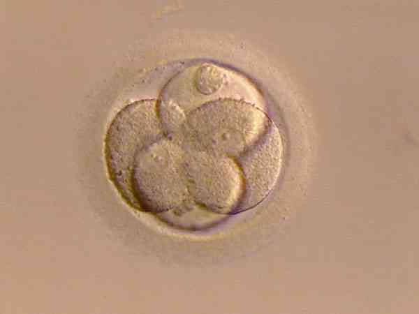 为什么试管同一天移植囊胚孕周会差一周？