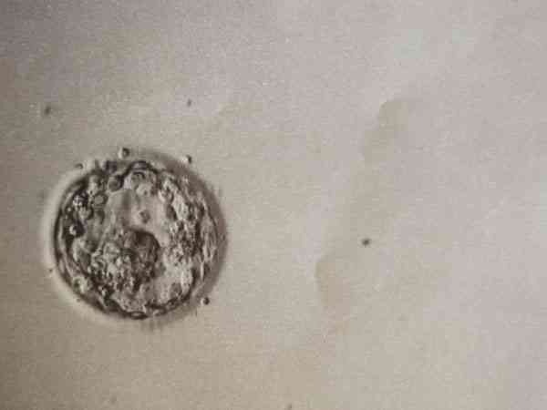 29岁做三代试管婴儿移植一个囊胚成功率高吗？