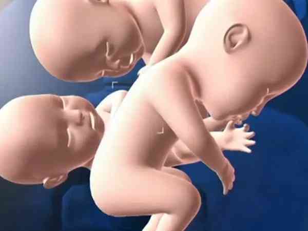 试管怀上三胞胎减胎减一个还是两个比较好？