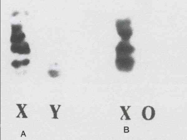 胚胎染色体xo是男方还是女方问题导致？