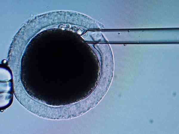 什么是显微受精？和体外受精有什么区别？