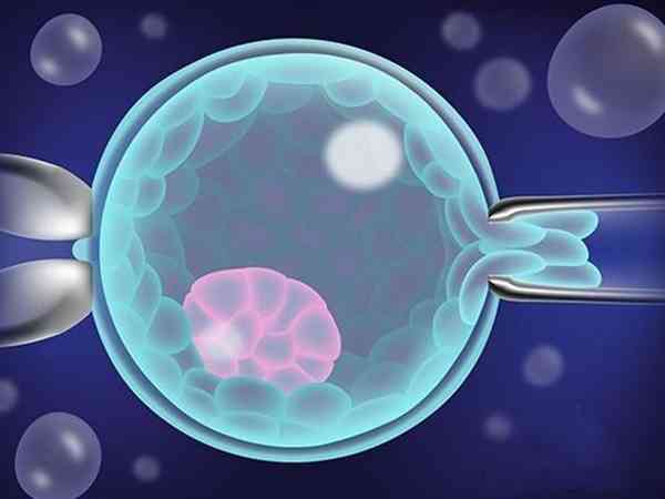 冷冻胚胎移植术前要做的五个准备是什么？