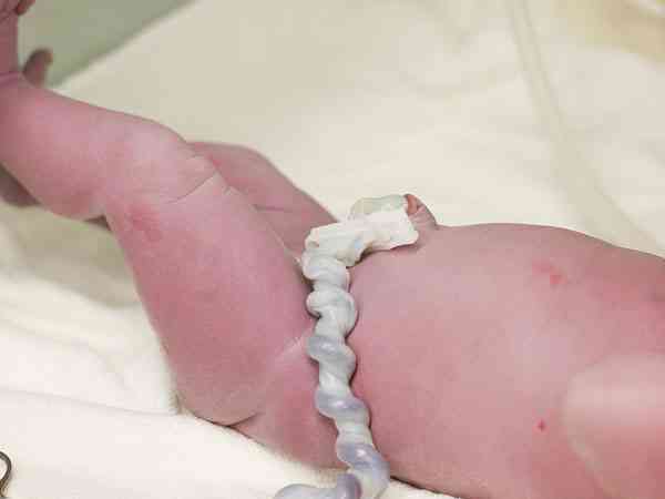 试管婴儿出生后有脐带和肚脐眼儿吗？