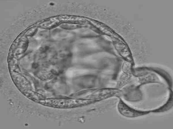 做一代试管移植的囊胚一般是生女儿还是儿子？