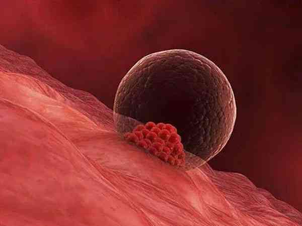 人抗膜联蛋白a2高会影响胚胎着床或导致胎停吗？