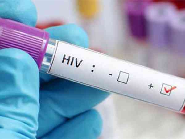 北京市清华大学医院有开展HIV洗精术吗？