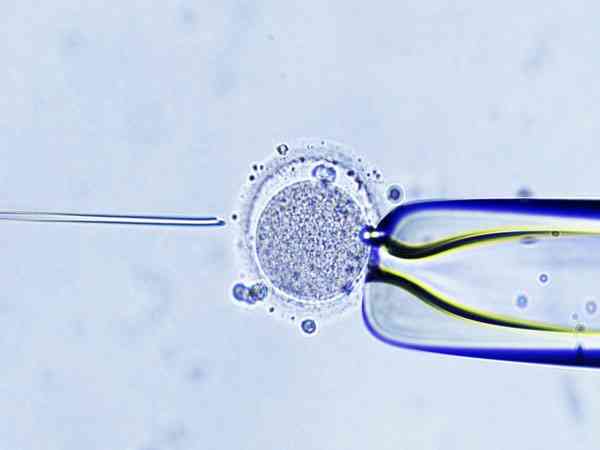 男性患早期阴囊癌能做试管婴儿要孩子吗？