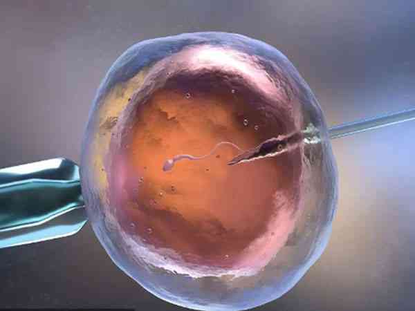 骨癌化疗后可以取精子做试管婴儿进行生育吗？