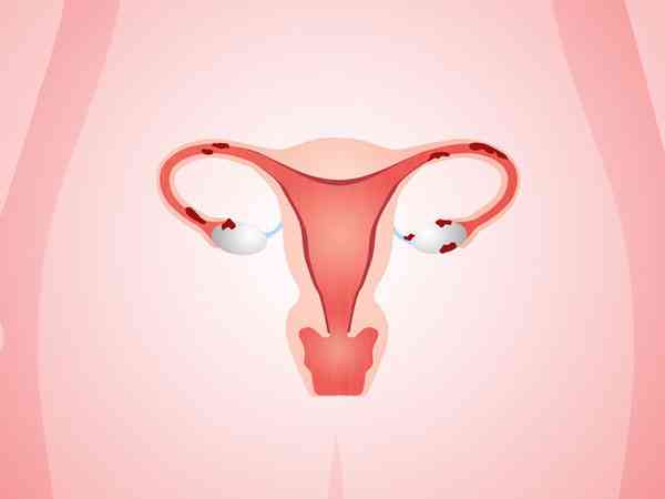 子宫偏大做试管移植对胚胎着床有影响吗？