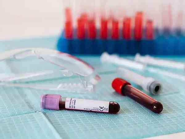 东莞哪个私人医院可以验血查胎儿性别男女？