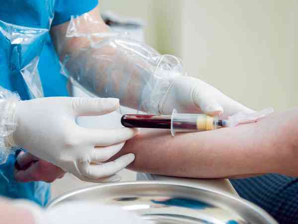 试管移植前一定要空腹抽血检查性激素六项吗？