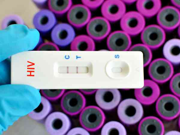 国内哪里可以帮助hiv双阳家庭做试管生孩子？
