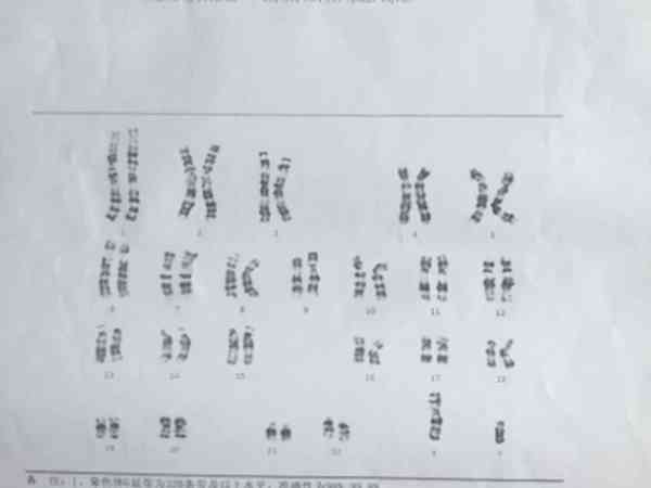 男性染色体缺失能在银川永宁县人民医院做试管吗？