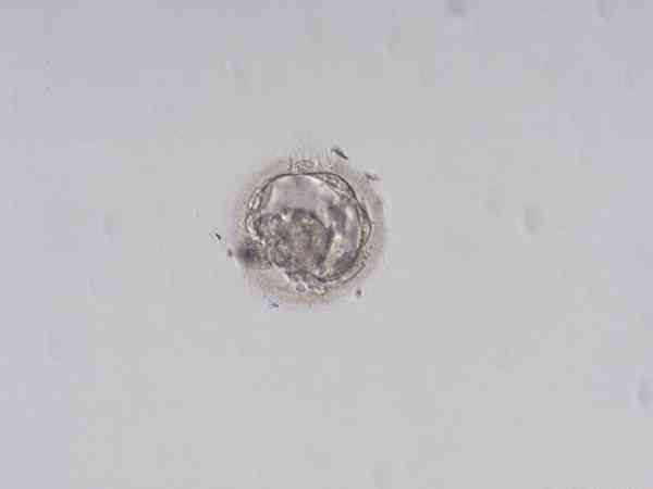 养囊9个成3个是不胚胎质量不好？