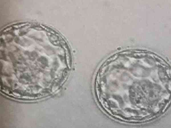 14个胚胎养囊才养了4个是什么原因造成的？