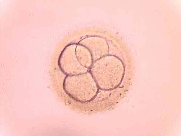 20个胚胎养囊18个风险大不大？