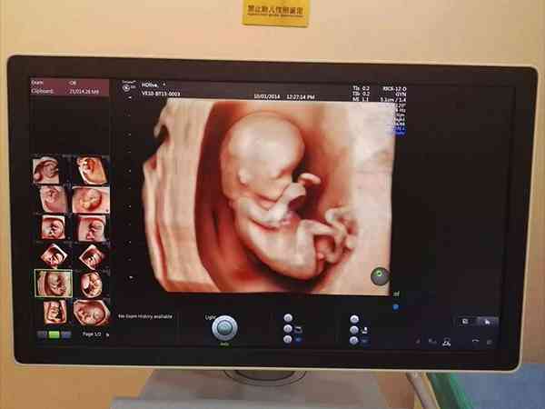 胎儿1一40周体重对照表中七个月胎儿几斤最好？