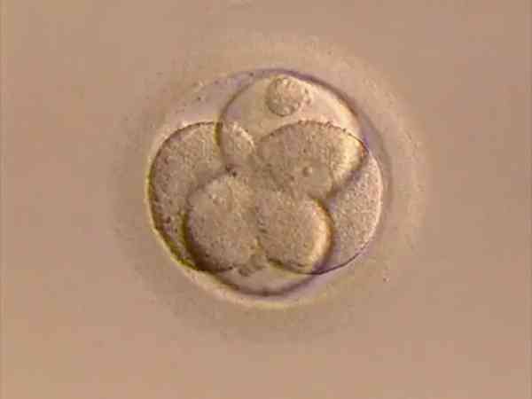 8细胞胚胎碎片率高达30%能移植成功吗？