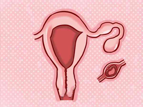 宫外孕药物保守治疗后多久能再移植冻胚？