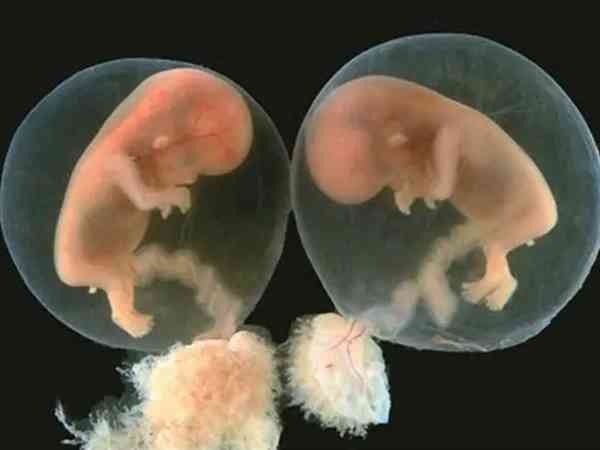 移植一个冻胚但前两天同房了会怀上双绒双羊双胞胎吗？