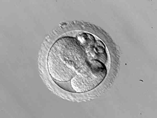 胚胎碎片率高是什么原因造成？精卵质量差只是其一
