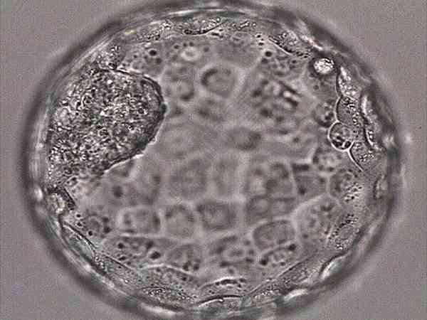 囊胚4bc为什么叫黑马？看完这些案例你就知道了