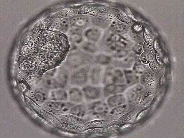 6个囊胚5个女儿是染色体有问题吗？还可以移植吗？